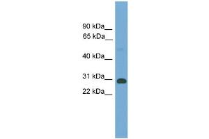 WB Suggested Anti-Tgifx1 Antibody Titration:  0.