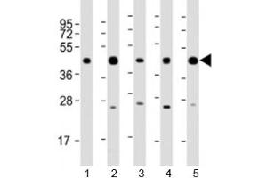 Western blot testing of human 1) 293T/17, 2) A431, 3) HeLa, 4) Jurkat and 5) K562 cell lysate with PHF6 antibody at 1:2000. (PHF6 Antikörper  (AA 315-349))