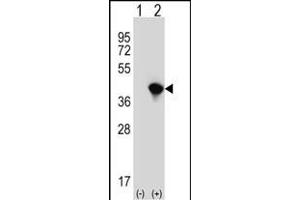 Western blot analysis of JTV1 (arrow) using rabbit polyclonal JTV1 Antibody (Center) (ABIN389383 and ABIN2839480). (AIMP2 Antikörper  (AA 156-184))