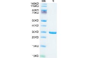 SARS-COV-2 NSP7&NSP8 on Tris-Bis PAGE under reduced condition. (SARS-CoV-2 NSP7, NSP8 (AA 1-83) protein (His tag))