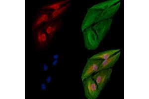ABIN6258507 and ABIN6274710 staining  cells by IF/ICC. (EFTUD2 Antikörper  (N-Term))