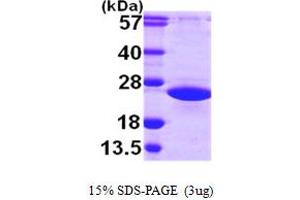 ADP-Ribosylation Factor-Like 2 (ARL2) (AA 1-184) protein (His tag)