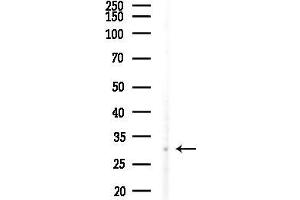 Western blot analysis of lysates from MDA-MB-231 cells(heat-shock,45 min treatment), using HOXC12 Antibody at 1/1000 dilution.