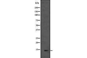 Western blot analysis of L36mt expression in HEK293 cells ,The lane on the left is treated with the antigen-specific peptide. (MRPL36 Antikörper  (Internal Region))