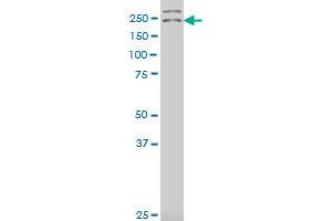 DENND4A polyclonal antibody (A01), Lot # 060613JCS1 Western Blot analysis of DENND4A expression in U-2 OS . (DENND4A Antikörper  (AA 1-101))