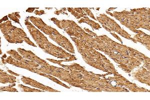 Immunohistochemistry (IHC) image for anti-Matrix Metallopeptidase 9 (Gelatinase B, 92kDa Gelatinase, 92kDa Type IV Collagenase) (MMP9) (AA 108-508) antibody (ABIN7445843)