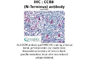 Image no. 1 for anti-Chemokine (C-C Motif) Receptor 8 (CCR8) (Extracellular Domain), (N-Term) antibody (ABIN1732786) (CCR8 Antikörper  (Extracellular Domain, N-Term))