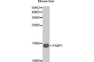 Western blot analysis of extracts of mouse liver, using FABP1 antibody (ABIN5973056) at 1/1000 dilution. (FABP1 Antikörper)