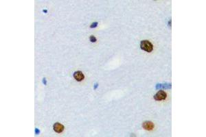 Immunohistochemical analysis of hnRNP LL staining in human brain formalin fixed paraffin embedded tissue section. (HNRPLL Antikörper  (Center))