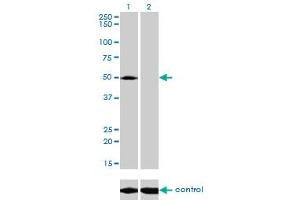 Western blot analysis of ACP2 over-expressed 293 cell line, cotransfected with ACP2 Validated Chimera RNAi (Lane 2) or non-transfected control (Lane 1).