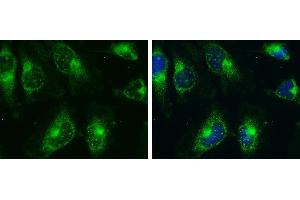 ICC/IF Image AMPK alpha 2 antibody detects AMPK alpha 2 protein at cytoplasm and nucleus by immunofluorescent analysis. (PRKAA2 Antikörper  (Center))