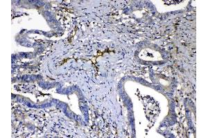 Immunohistochemistry (IHC) image for anti-Homer Homolog 3 (Drosophila) (HOMER3) (AA 282-360) antibody (ABIN5518917)