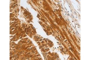 Immunohistochemistry (IHC) image for anti-Complement Factor H-Related 1 (CFHR1) antibody (ABIN1871806) (CFHR1 Antikörper)