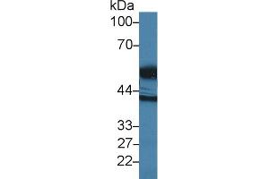 Western Blot; Sample: Human E. (High Temperature Requirement Factor A1 (AA 304-442) Antikörper)