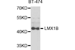 Western blot analysis of extracts of BT-474 cells, using LMX1B antibody (ABIN5975264) at 1/1000 dilution.