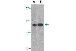 Western blot analysis of MARVELD1 in mouse heart tissue lysate with MARVELD1 polyclonal antibody  at (A) 1 and (B) 2 ug/mL .