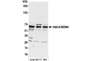 Western Blotting (WB) image for anti-Mdm4-binding Protein (MDM4) (AA 125-175) antibody (ABIN7449748)