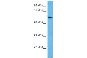 Host:  Mouse  Target Name:  VIM  Sample Tissue:  Mouse Small Intestine  Antibody Dilution:  1ug/ml (Vimentin Antikörper  (N-Term))