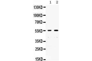 Western Blotting (WB) image for anti-X-Ray Repair Complementing Defective Repair in Chinese Hamster Cells 4 (XRCC4) (AA 49-75), (N-Term) antibody (ABIN3044561)