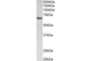 Western Blotting (WB) image for anti-SRY (Sex Determining Region Y)-Box 11 (SOX11) (Internal Region) antibody (ABIN2464999) (SOX11 Antikörper  (Internal Region))