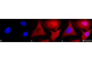 Immunocytochemistry/Immunofluorescence analysis using Mouse Anti-Ubiquitin Monoclonal Antibody, Clone 6C11-B3 . (Ubiquitin Antikörper  (Biotin))