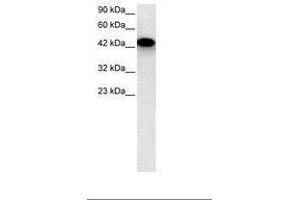 Image no. 2 for anti-Eyes Absent Homolog 3 (EYA3) (AA 277-326) antibody (ABIN6735802) (EYA3 Antikörper  (AA 277-326))