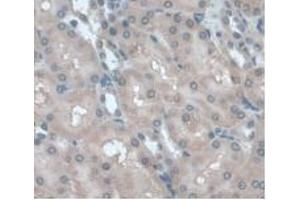 Detection of a1AGP in Rat Kidney Tissue using Monoclonal Antibody to Alpha-1-Acid Glycoprotein (a1AGP) (ORM1 Antikörper  (AA 20-186))