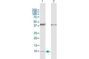 Western Blot analysis of CCL14 expression in transfected 293T cell line by CCL14 MaxPab polyclonal antibody. (CCL14 Antikörper  (AA 1-93))