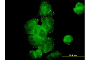 Immunofluorescence of monoclonal antibody to DCTN2 on MCF-7 cell.