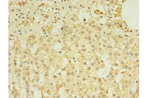Immunohistochemistry of paraffin-embedded human adrenal gland tissue using ABIN7173349 at dilution of 1:100 (TREML2 Antikörper  (AA 19-268))