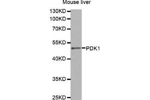Western Blotting (WB) image for anti-3-phosphoinositide Dependent Protein Kinase-1 (PDPK1) (AA 1-150) antibody (ABIN5663787) (PDPK1 Antikörper  (AA 1-150))