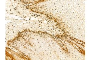 ABIN7094280 and ABIN7098327 at 1/100 staining Human normal tissues adjacent to esophageal cancer by IHC-P. (HNRNPR Antikörper  (C-Term))