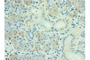 Immunohistochemistry of paraffin-embedded human pancreatic tissue using ABIN7169136 at dilution of 1:100 (PAK6 Antikörper  (AA 1-270))