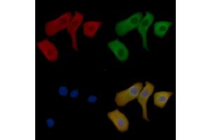 CTNNAL1 Mouse Monoclonal Antibody staining Hela cells by IF/ICC. (CTNNAL1 Antikörper  (Internal Region))