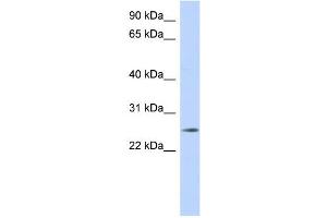 WB Suggested Anti-NKAIN4 Antibody Titration: 0. (NKAIN4 Antikörper  (Middle Region))