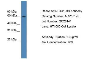 WB Suggested Anti-TBC1D19  Antibody Titration: 0.
