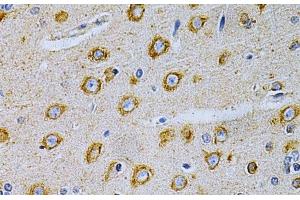 Immunohistochemistry of paraffin-embedded Rat brain using OLR1 Polyclonal Antibody at dilution of 1:200 (40x lens).