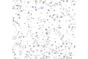 Immunocytochemistry (ICC) image for anti-AT Rich Interactive Domain 1B (SWI1-Like) (ARID1B) (AA 1425-1475) antibody (ABIN7795694) (Rekombinanter ARID1B Antikörper  (AA 1425-1475))