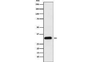 Western blot analysis of Apolipoprotein F expression in human plasma cell lysate.