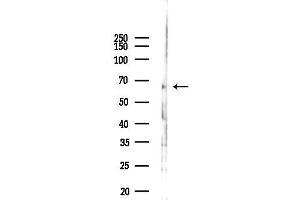 anti-Endogenous Retrovirus Group 3, Member 1 (ERV3-1) antibody