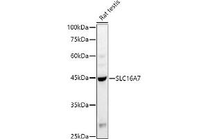 Western blot analysis of extracts of Rat testis, using (ABIN6134859, ABIN6147861, ABIN6147862 and ABIN6215999) at 1:1000 dilution.