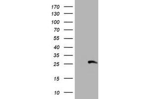 Western Blotting (WB) image for anti-Regulatory Factor X-Associated Ankyrin Containing Protein (RFXANK) antibody (ABIN1500683) (RFXANK Antikörper)