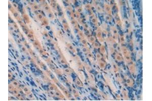 IHC-P analysis of Mouse Stomach Tissue, with DAB staining. (SOD2 Antikörper  (AA 25-222))
