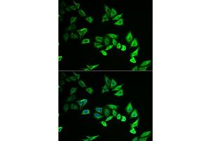 Immunofluorescence analysis of U2OS cells using MYOZ2 antibody (ABIN6129772, ABIN6144299, ABIN6144300 and ABIN6222126). (MYOZ2 Antikörper  (AA 1-264))