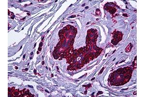 Anti-MYH9 antibody IHC of human breast. (Myosin 9 Antikörper)
