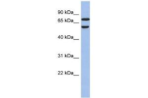 GNL3L antibody used at 1 ug/ml to detect target protein. (GNL3L Antikörper)