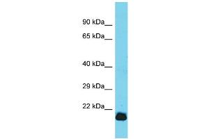Host: Rabbit  Target Name: Gpx7  Sample Tissue: Rat Heart lysates  Antibody Dilution: 1. (Glutathione Peroxidase 7 Antikörper  (C-Term))