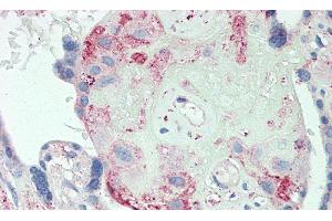 Detection of ORM2 in Human Placenta Tissue using Polyclonal Antibody to Orosomucoid 2 (ORM2)