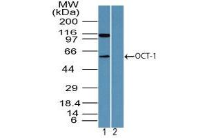 Image no. 2 for anti-POU Domain, Class 2, Transcription Factor 1 (POU2F1) (AA 1-50) antibody (ABIN960311) (POU2F1 Antikörper  (AA 1-50))