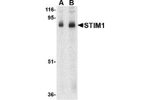 Western Blotting (WB) image for anti-Stromal Interaction Molecule 1 (STIM1) (C-Term) antibody (ABIN1030706)